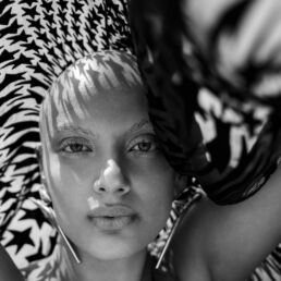 Rihan lives with Alopecia, a condition that causes complete hair loss